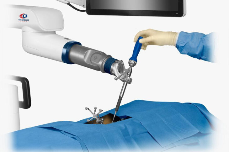 Chirurgia vertebrale: ExcelsiusGPS è il nuovo braccio destro dei neurochirurghi