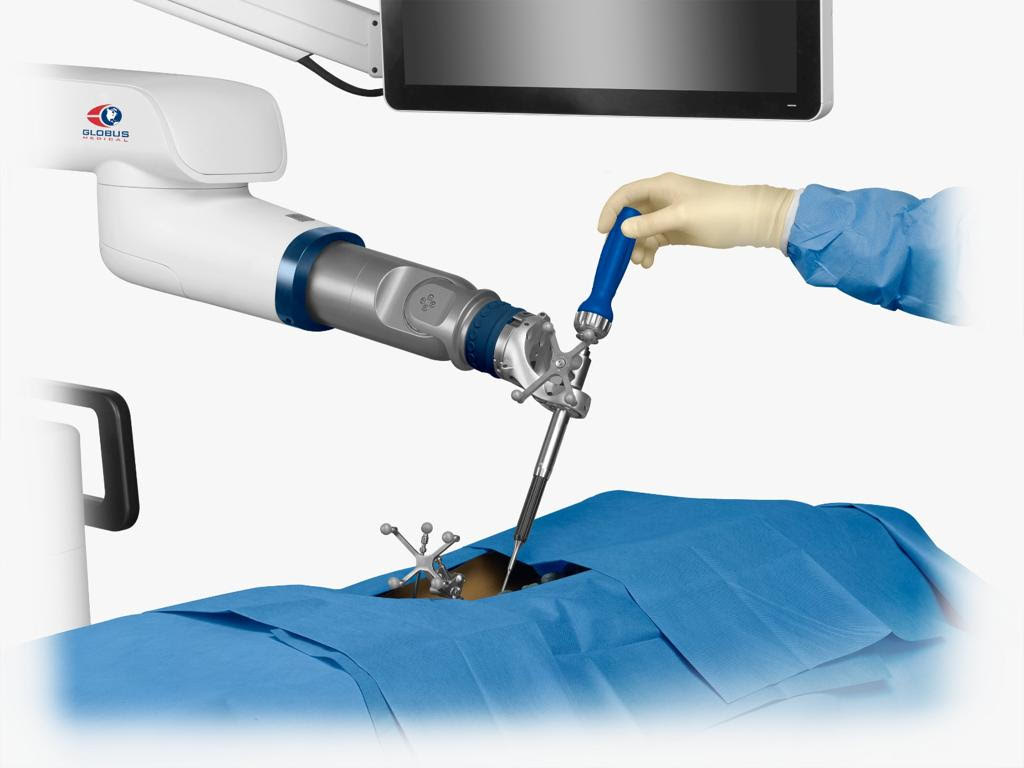 Chirurgia vertebrale: ExcelsiusGPS è il nuovo braccio destro dei neurochirurghi