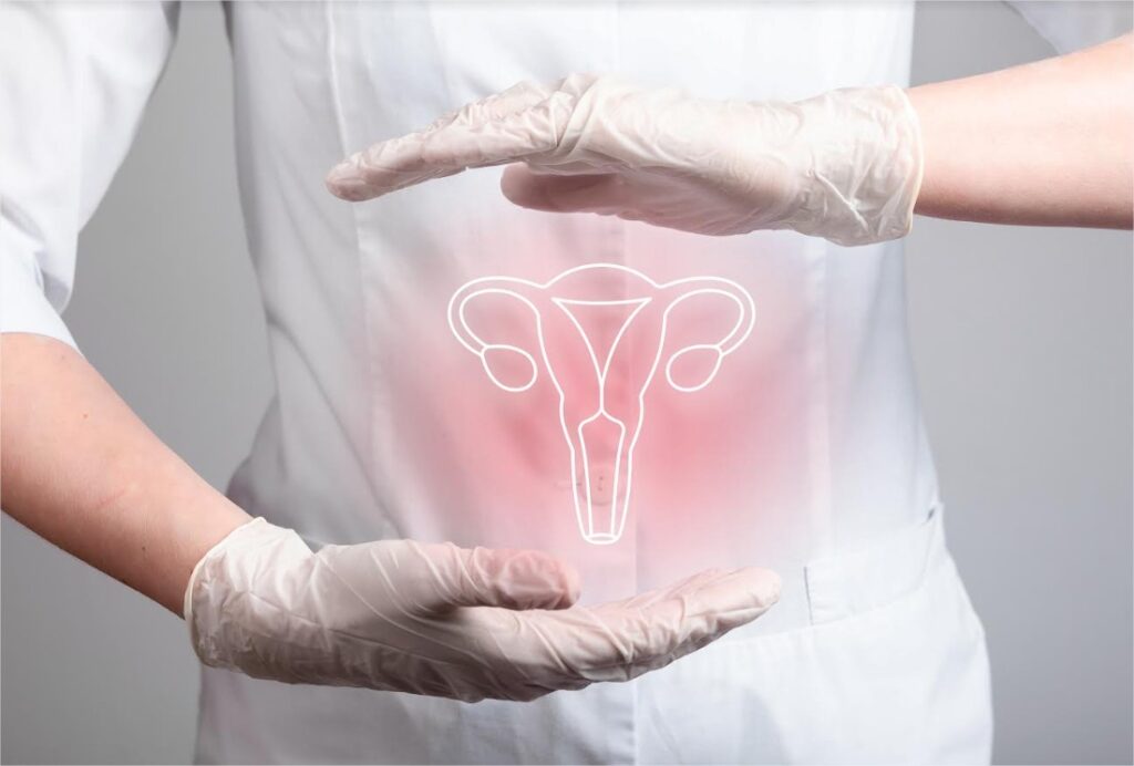  Terapia combinata di carboplatino e taxolo con dostarlimab rivoluziona il trattamento del tumore dell'endometrio