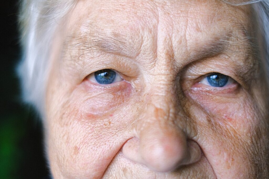 invecchiamento dell’apparato oculare